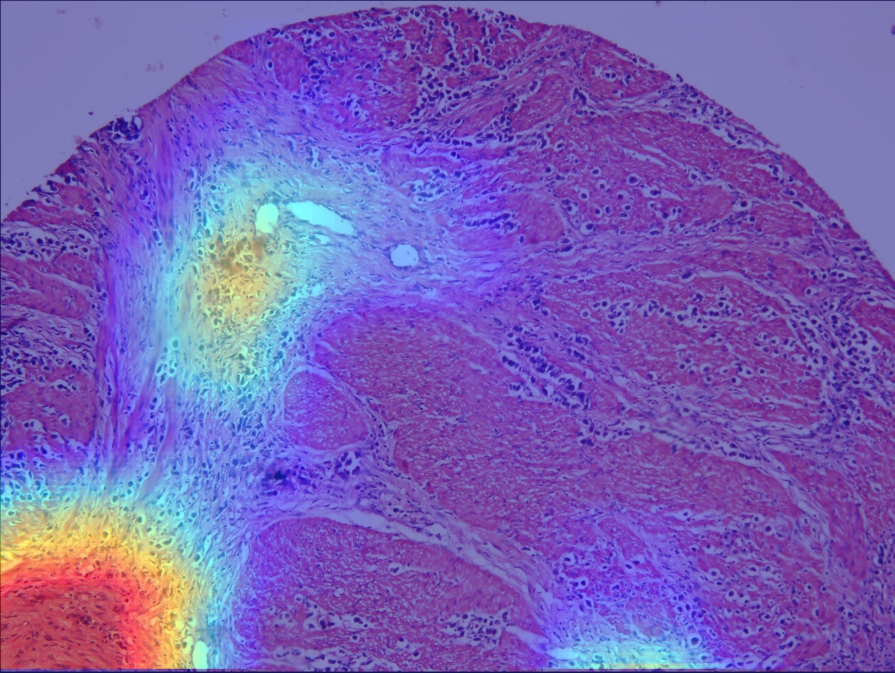 8-A1-heatmap.png