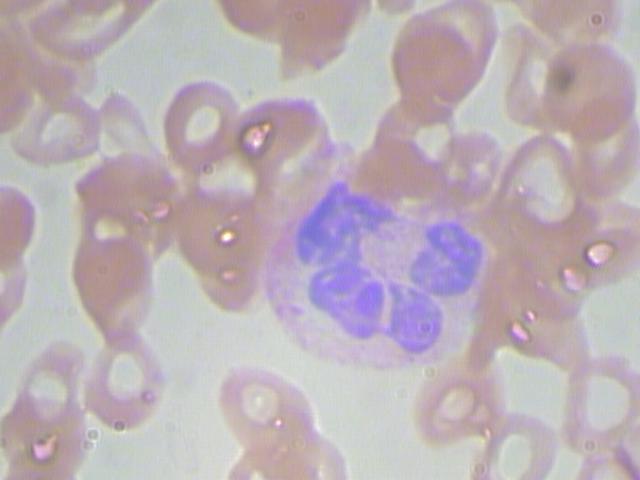 Neutrophil.jpg